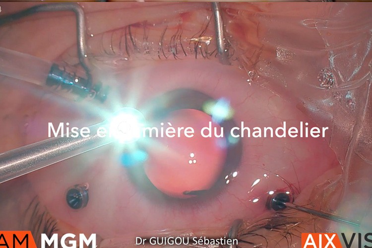 Mise en lumière du chandelier