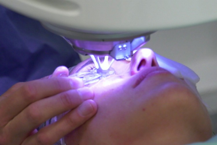 Real Surgery - Lasik Hypermétropie