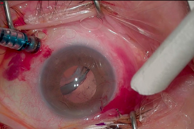 Carlevale plan séquence complet